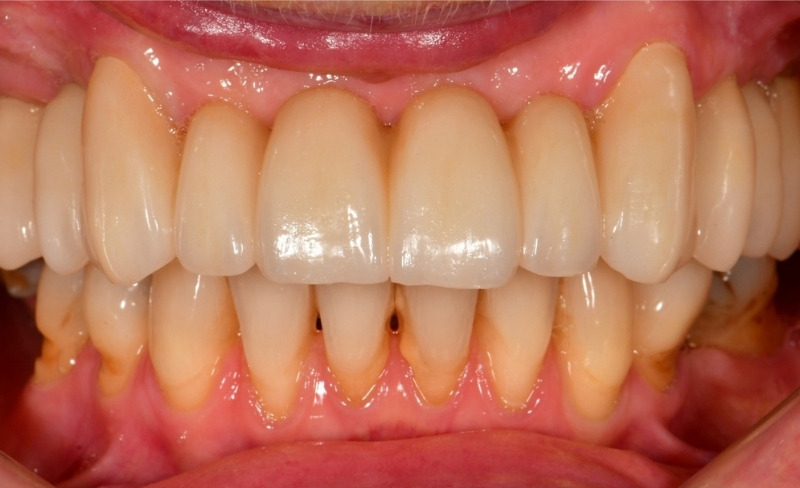 After -Bromsgrove Dental