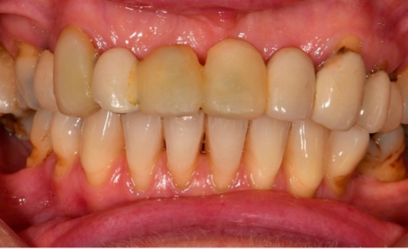 Before - Bromsgrove Dental