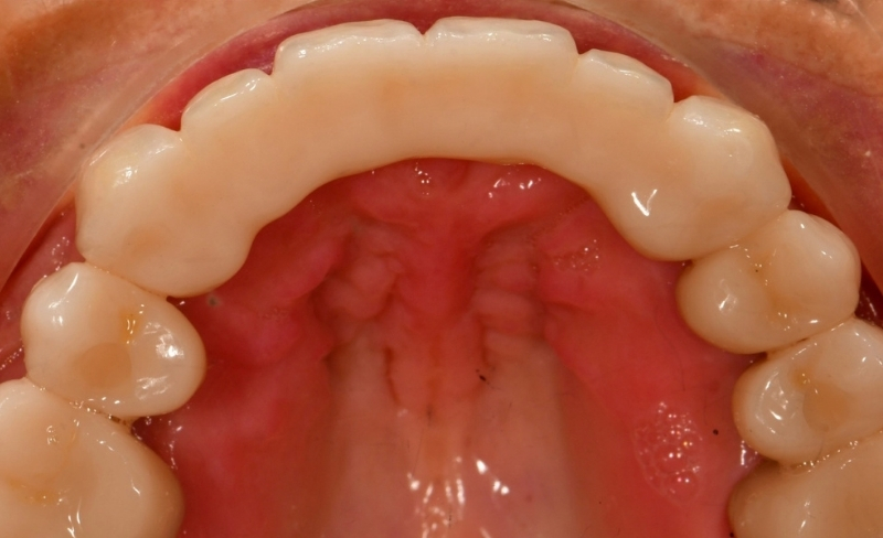 After -Bromsgrove Dental