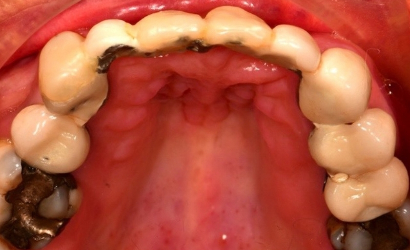 Before - Bromsgrove Dental