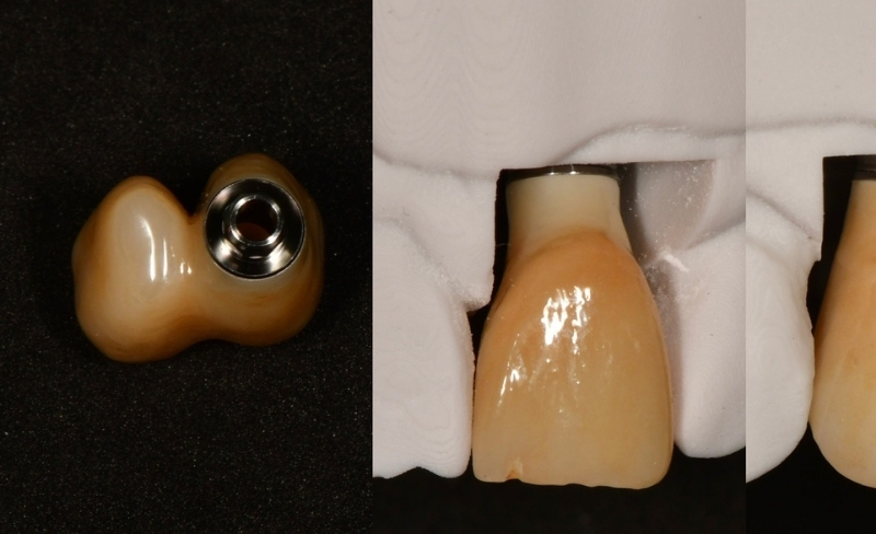 After -Bromsgrove Dental