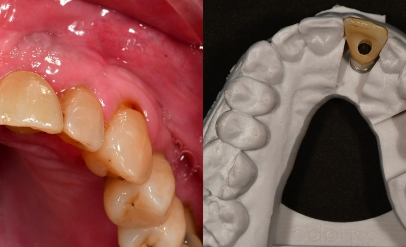 Before - Bromsgrove Dental