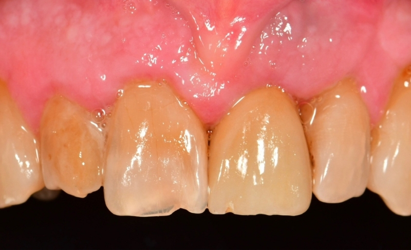 After -Bromsgrove Dental