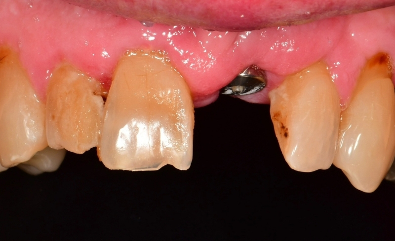 Before - Bromsgrove Dental