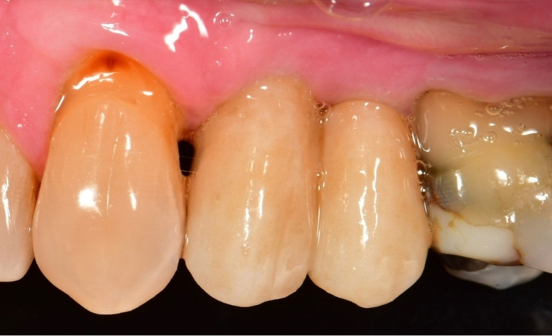 After -Bromsgrove Dental