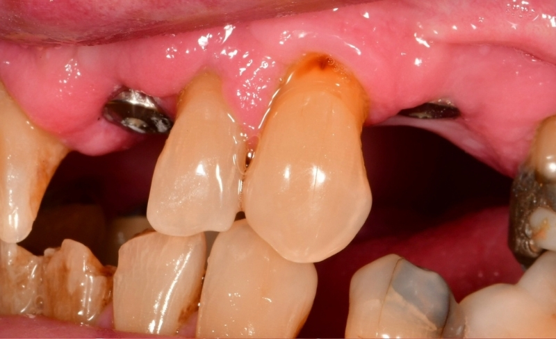 Before - Bromsgrove Dental