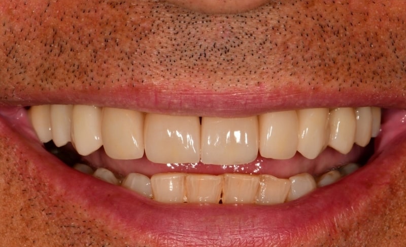 After -Bromsgrove Dental