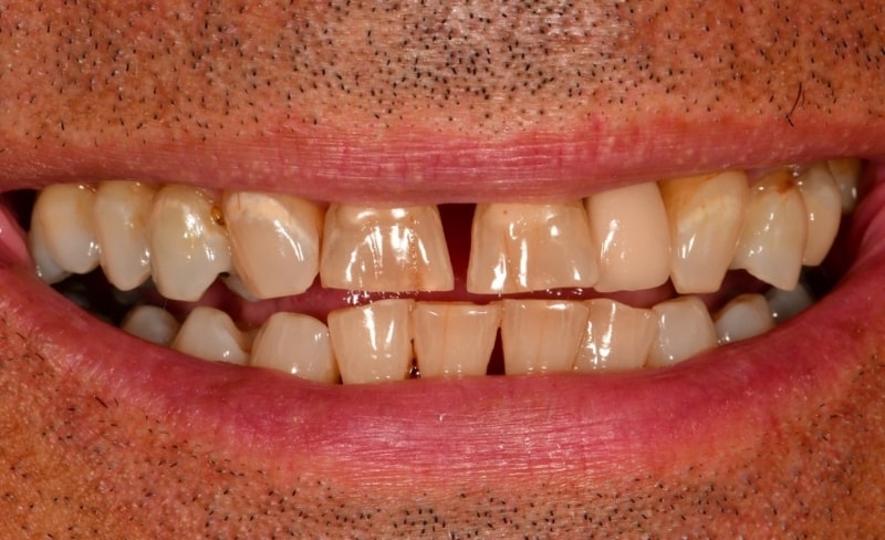 Before - Bromsgrove Dental