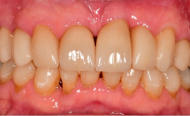 After -Bromsgrove Dental