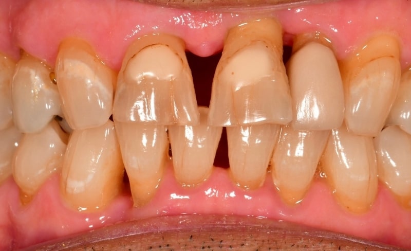 Before - Bromsgrove Dental