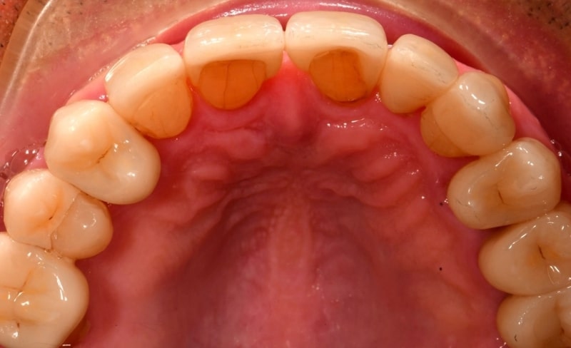 After -Bromsgrove Dental