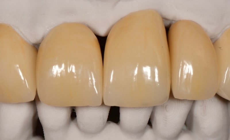 After -Bromsgrove Dental