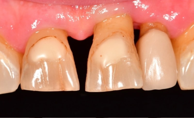 Before - Bromsgrove Dental