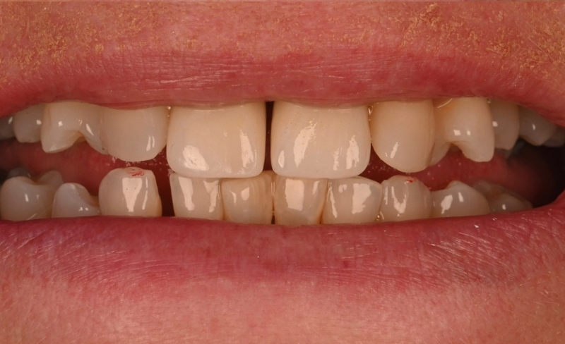 After -Bromsgrove Dental