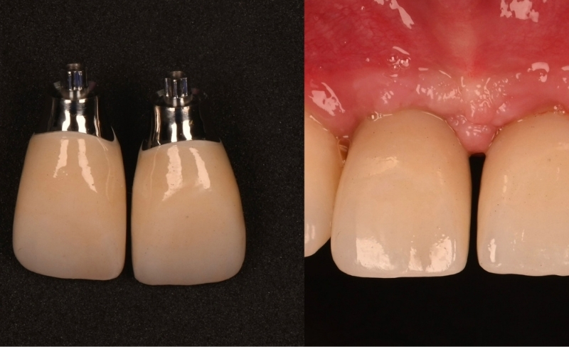 After -Bromsgrove Dental