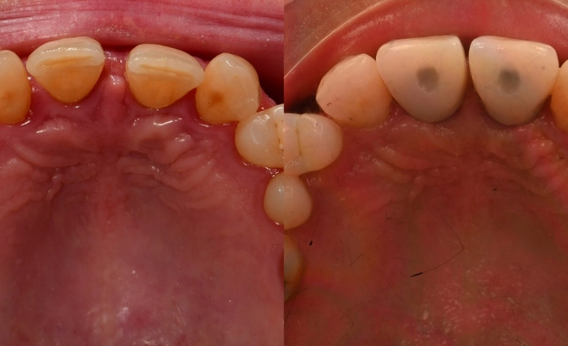 Before - Bromsgrove Dental