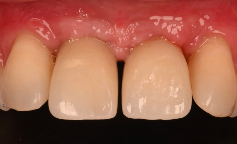 After -Bromsgrove Dental