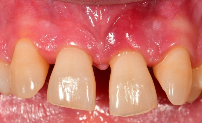 Before - Bromsgrove Dental