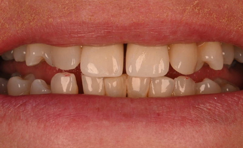 After -Bromsgrove Dental