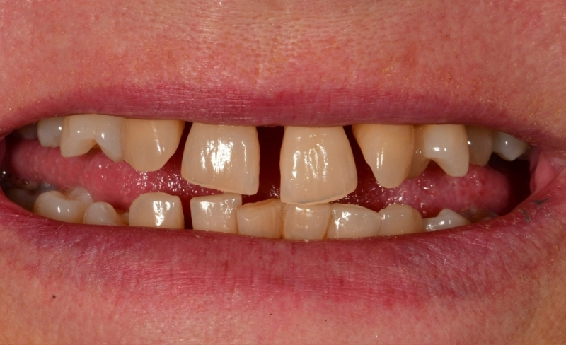 Before - Bromsgrove Dental