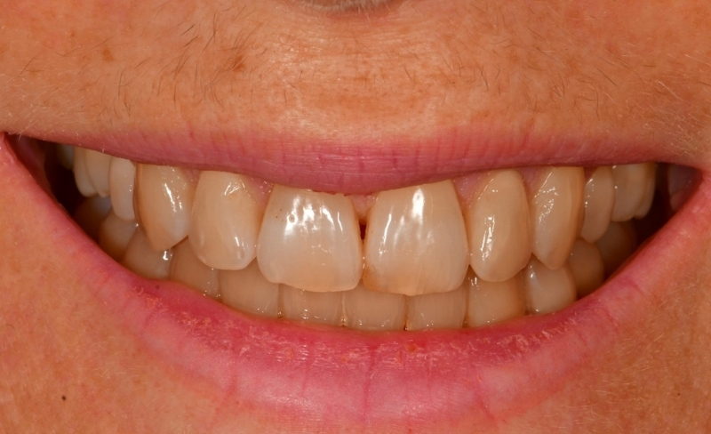 After -Bromsgrove Dental