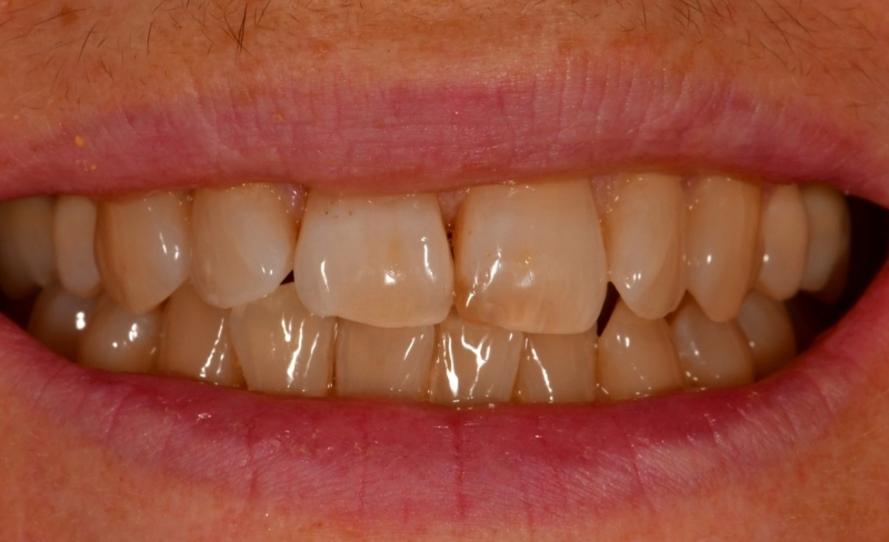 Before - Bromsgrove Dental