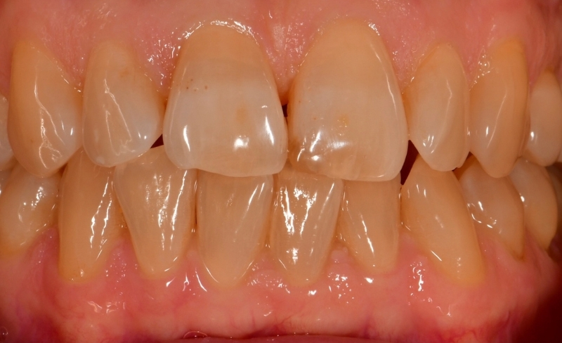 Before - Bromsgrove Dental