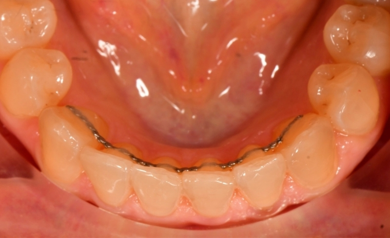 After -Bromsgrove Dental