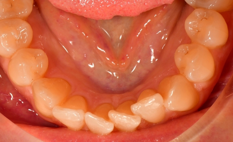 Before - Bromsgrove Dental