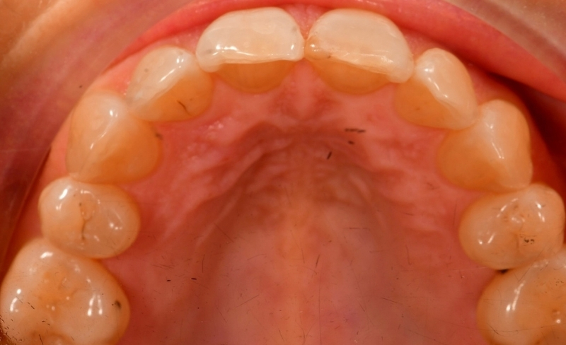 After -Bromsgrove Dental