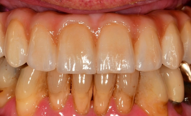 After -Bromsgrove Dental