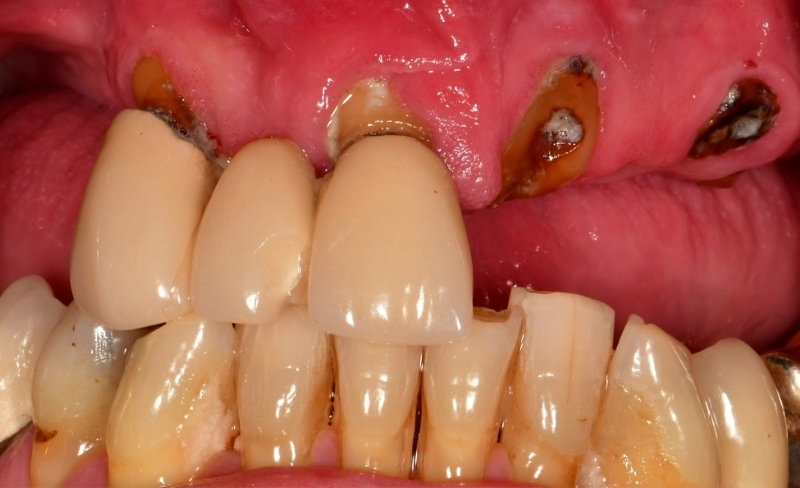 Before - Bromsgrove Dental