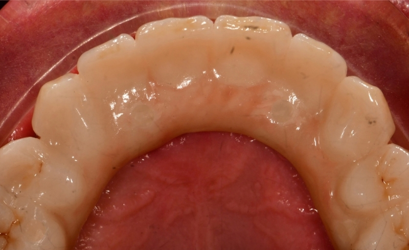 After -Bromsgrove Dental