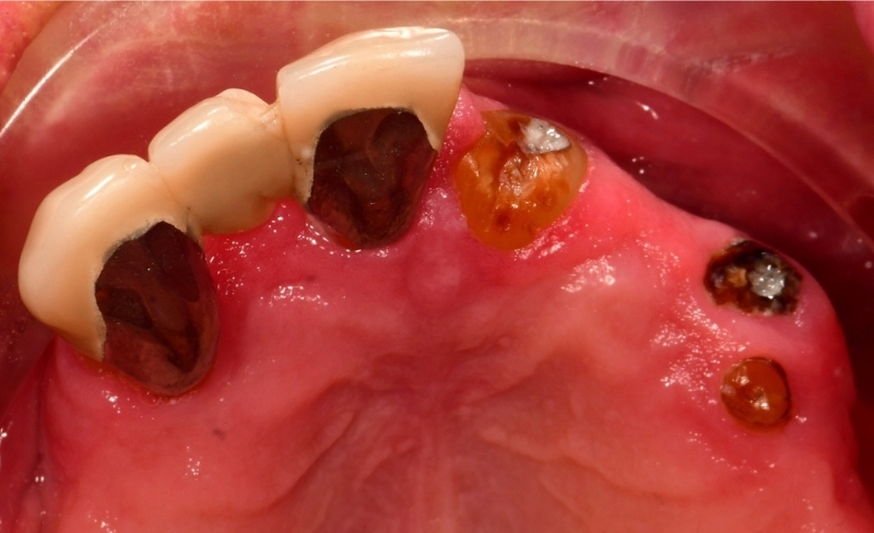 Before - Bromsgrove Dental