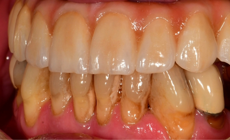 After -Bromsgrove Dental