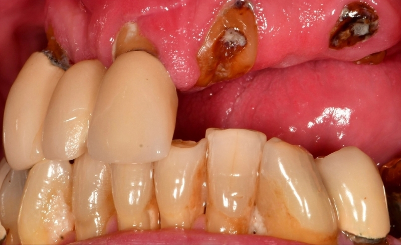 Before - Bromsgrove Dental