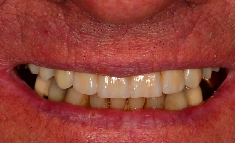 After -Bromsgrove Dental