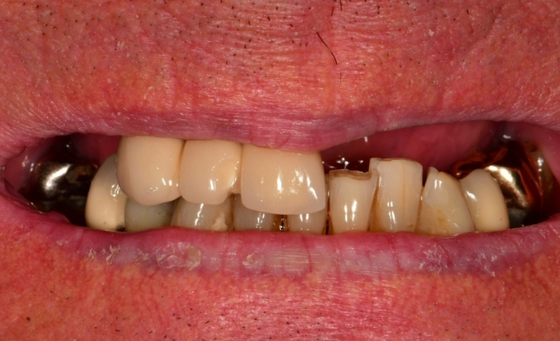 Before - Bromsgrove Dental