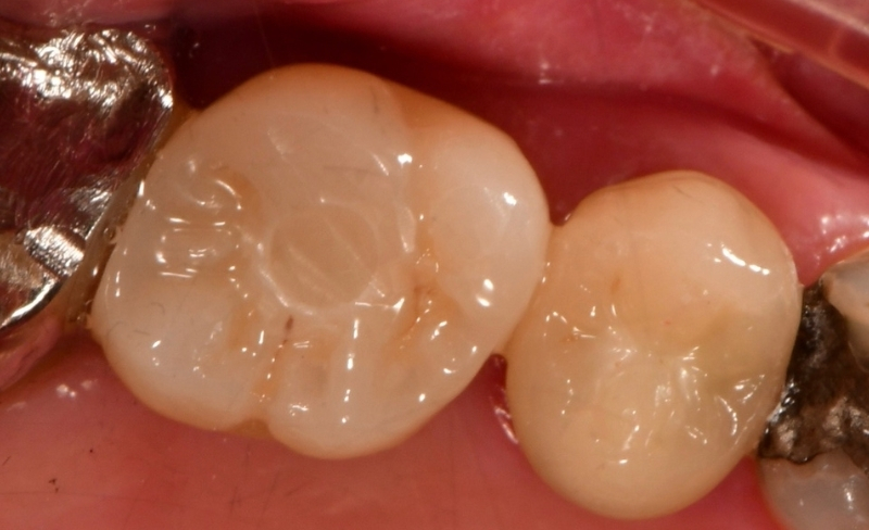 After -Bromsgrove Dental