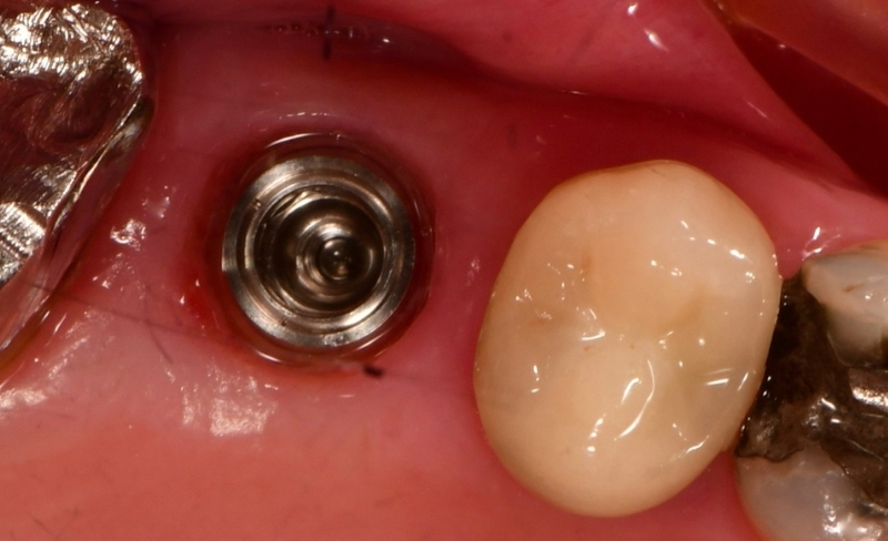 Before - Bromsgrove Dental