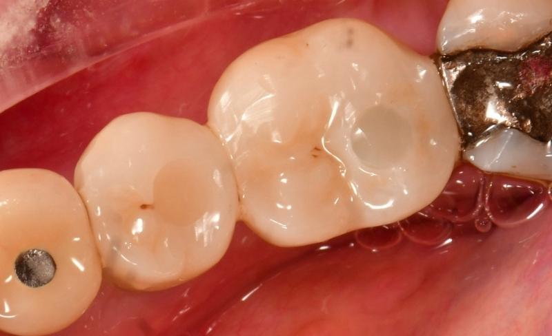 After -Bromsgrove Dental