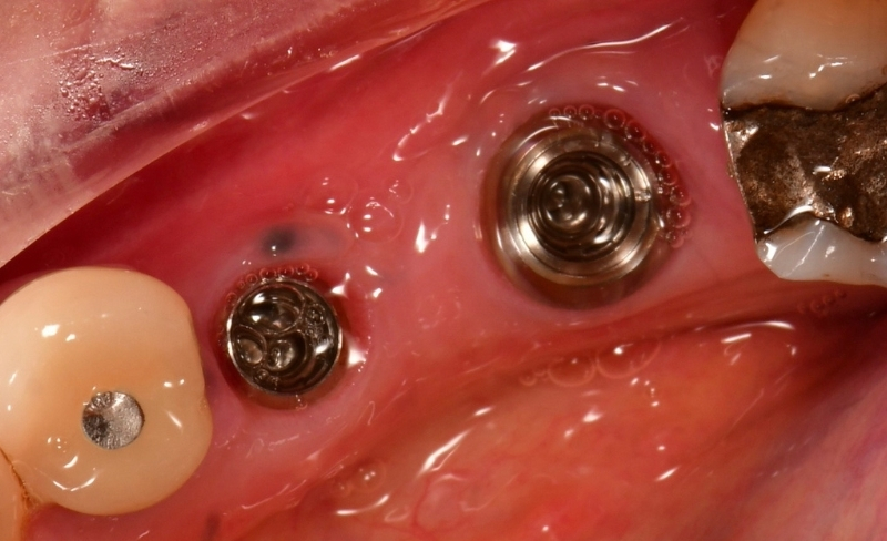 Before - Bromsgrove Dental