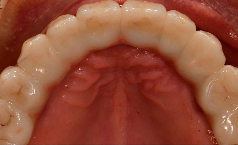 After -Bromsgrove Dental