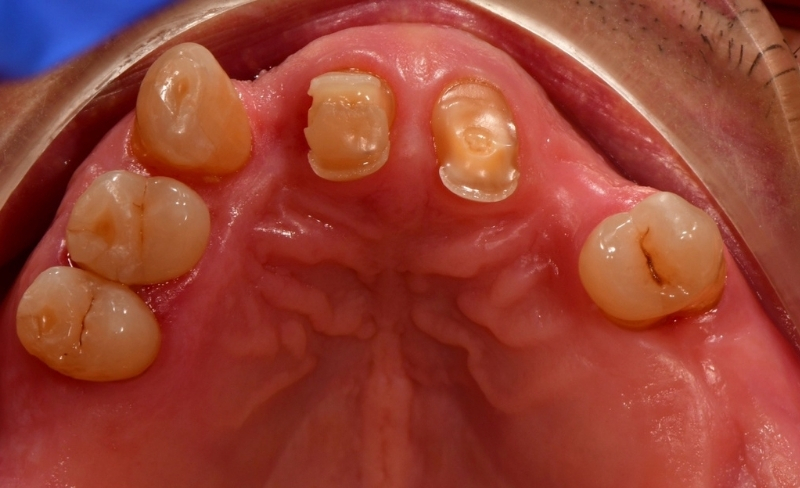 Before - Bromsgrove Dental