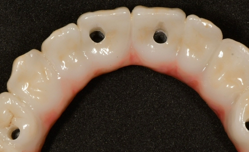 After -Bromsgrove Dental