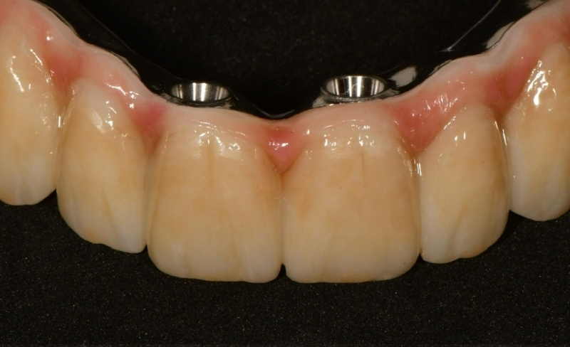 Before - Bromsgrove Dental