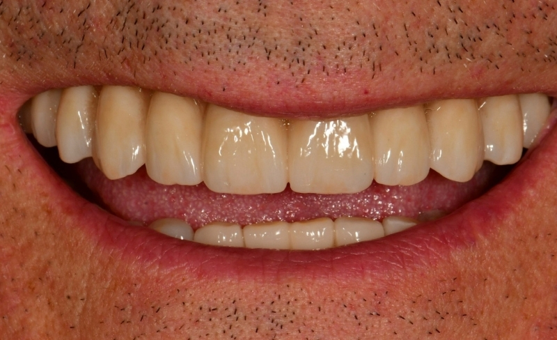 After -Bromsgrove Dental