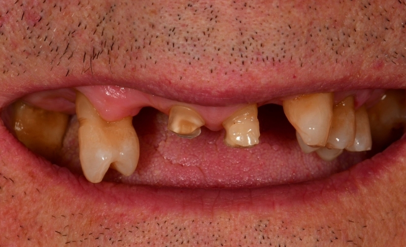 Before - Bromsgrove Dental