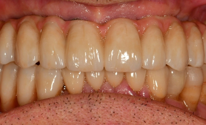 After -Bromsgrove Dental