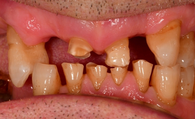 Before - Bromsgrove Dental